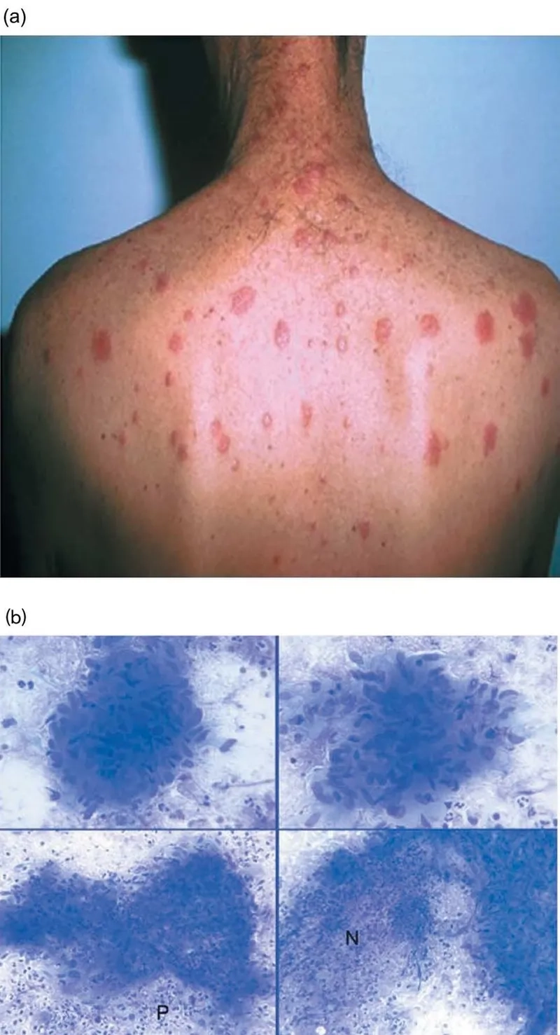 Understanding how HIV is transmitted