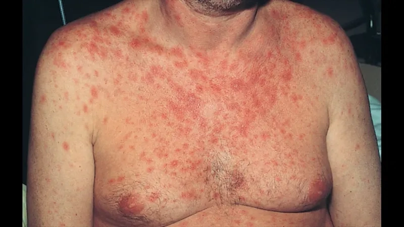 Modern advancements in HIV treatment