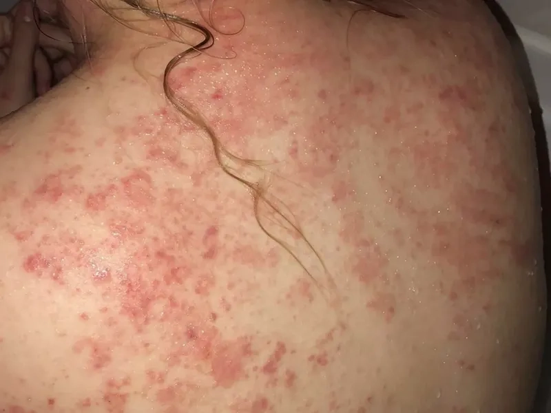 Key strategies for effective HIV/AIDS prevention