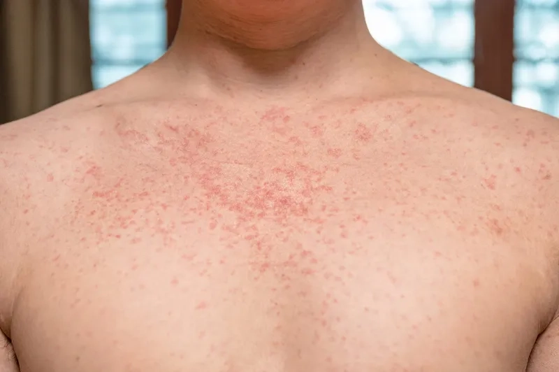 The importance of a confidential HIV test