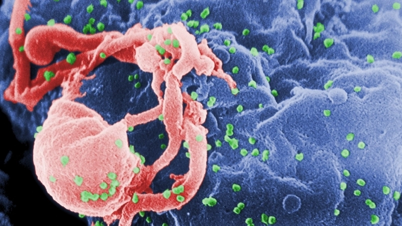 Human Immunodeficiency Virus HIV Infection AIDS HIV symptoms