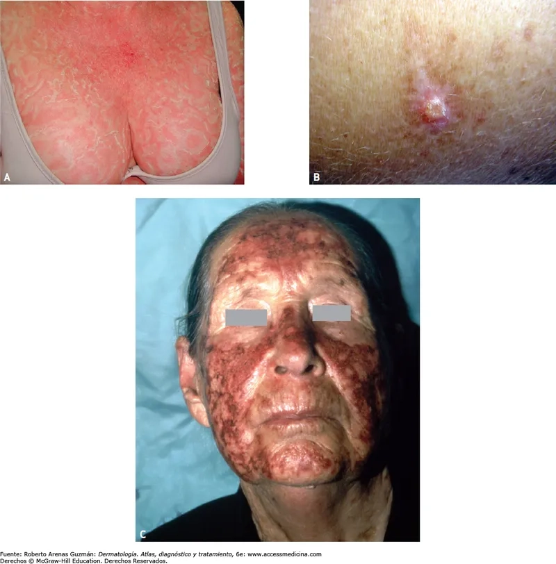 Microscopic image of the HTLV-1 virus