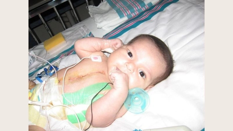 Hypoplastic right heart syndrome types variations and classification