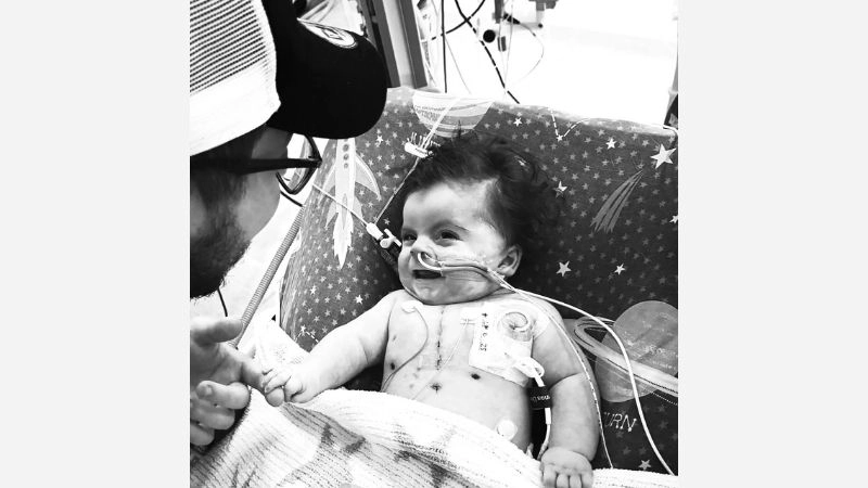 Hypoplastic right heart syndrome survival rate factors influencing