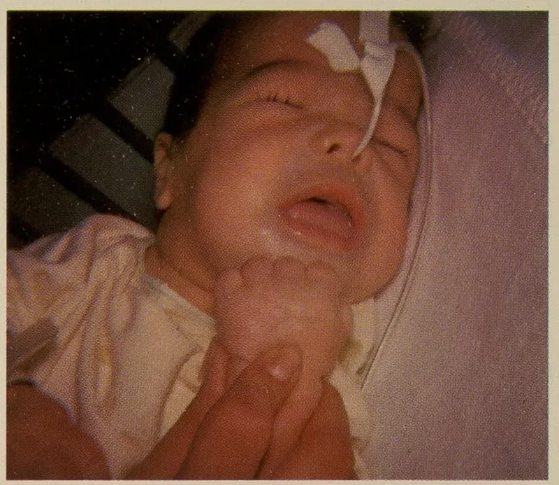 Healthy meal plan for hypothyroidism diet