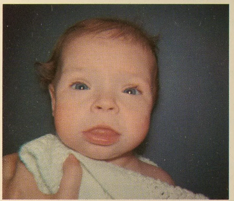 Infographic on Hashimoto's disease symptoms