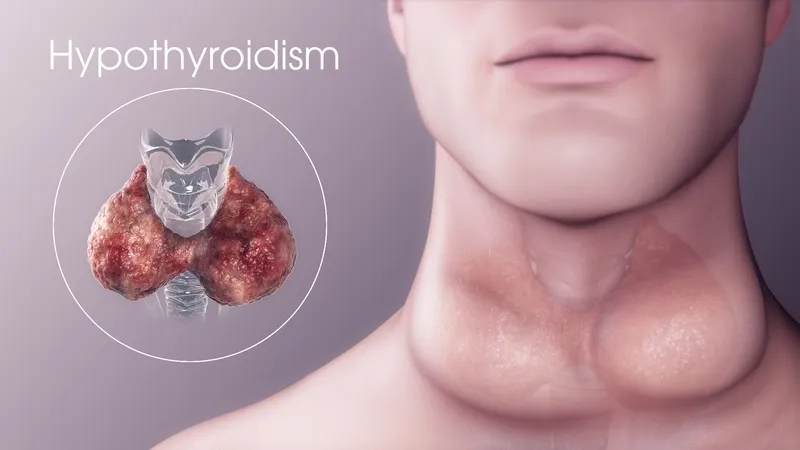 Patient reviewing hypothyroidism symptoms with doctor