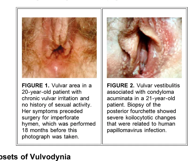 Vulvodynia specialist providing medical care