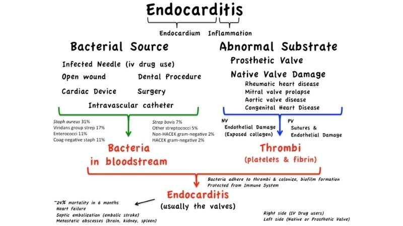 Infective endocarditis guidelines clinical standards for treatment