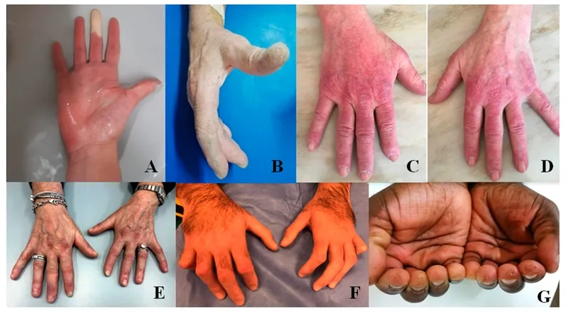 A physician making a definitive ILD diagnosis