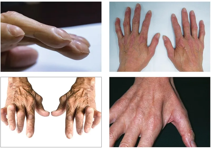 A doctor assessing a patient's pulmonary fibrosis symptoms