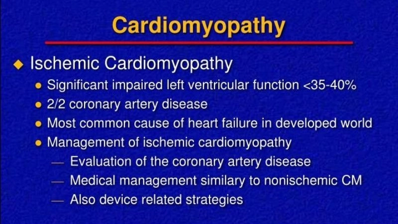 Ischemic cardiomyopathy treatment uses meds, devices, or surgery