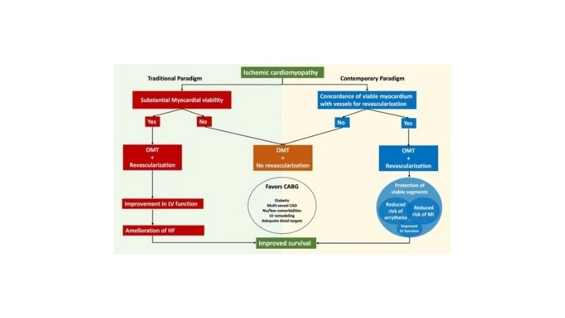 Ischemic cardiomyopathy diagnosis relies on echo, MRI, and tests