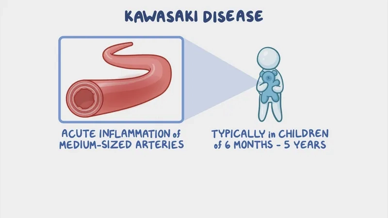 Clinical Kawasaki disease rash pictures on a patient
