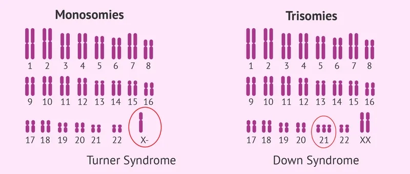 Klinefelter syndrome diagnosis and clinical process