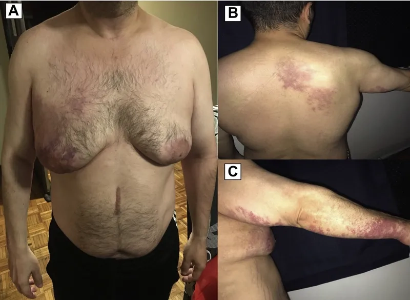 Klinefelter syndrome symptoms and health indicators