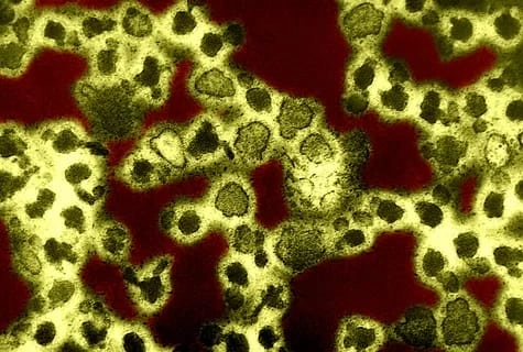 Identify Aedes triseriatus to prevent disease spread