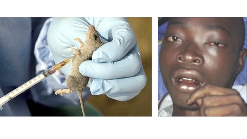 An infographic showing common Lassa fever symptoms