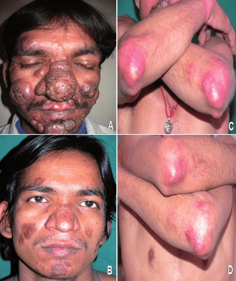 A diagram answering 'is Leishmaniasis contagious'