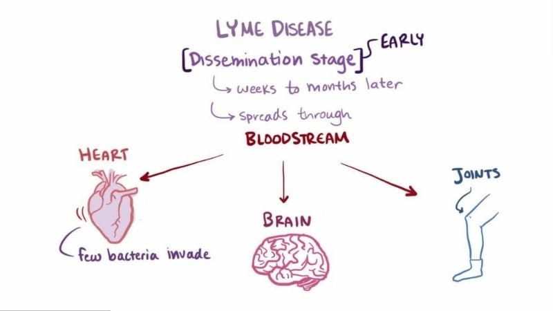 Lyme disease heart complications serious risks to circulation