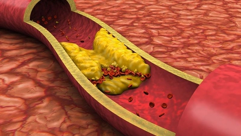Lyme carditis heart block dangerous disruption of heart rhythm