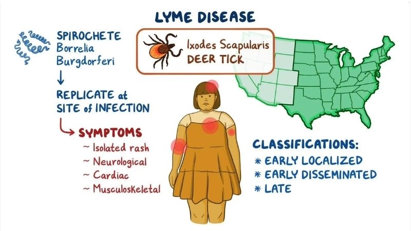 Lyme disease and chest pain concerning symptom of infection