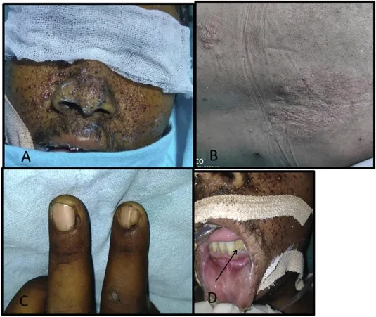 LAM Foundation support and awareness