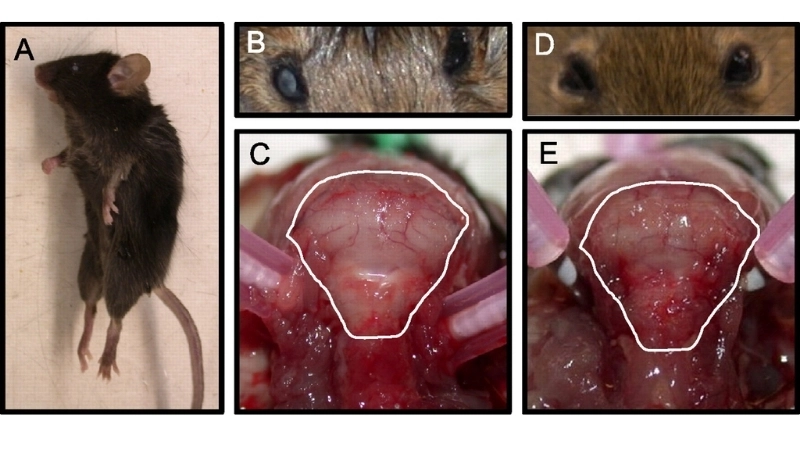 Learn about LCMV infections and early warning symptoms