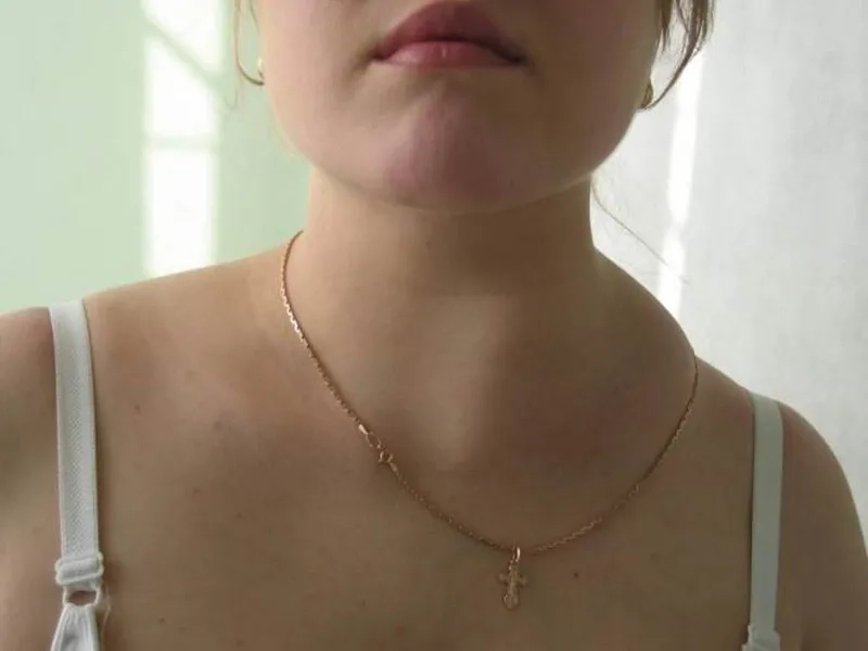 Prescription medication with antibiotics for LGV