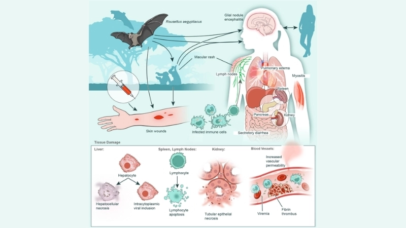 A medical chart of key Marburg virus symptoms