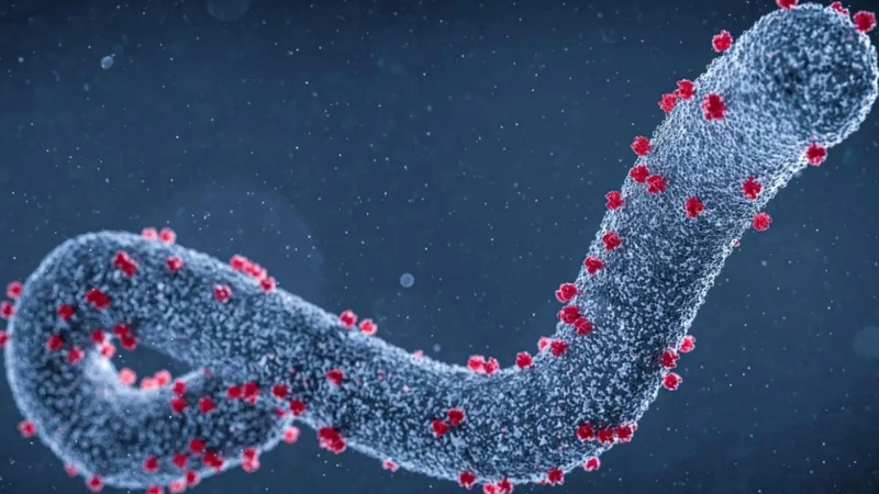 Supportive Marburg virus treatment in a clinical setting