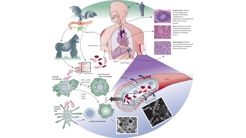 Comparing Marburg virus vs Ebola characteristics