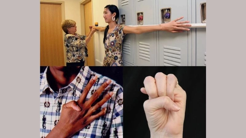 Scientific details about Marfan syndrome causes