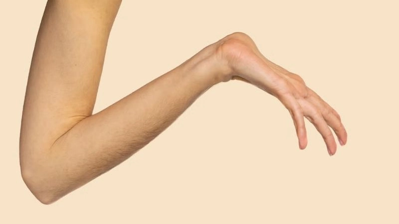 Future outlook on Marfan syndrome life expectancy