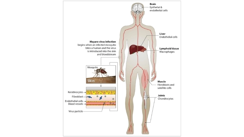 Effective Mayaro Virus Fever prevention tips