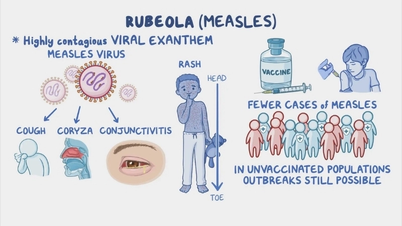 Measles (Rubeola) measles rash facts