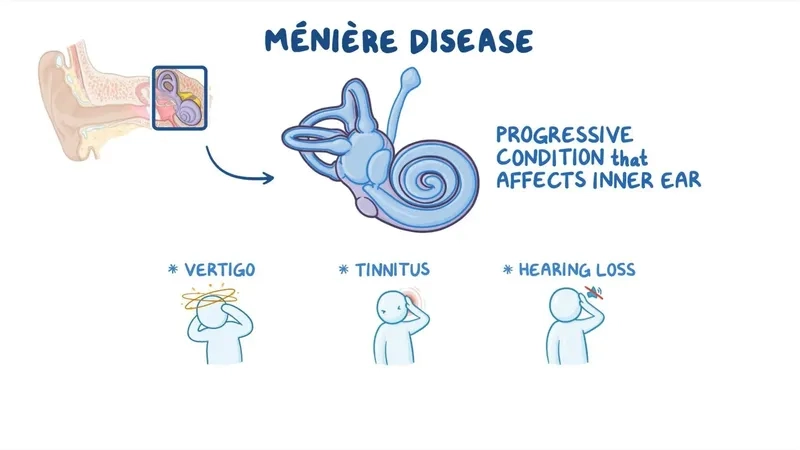 An inner ear diagram explaining what is Meniere's disease
