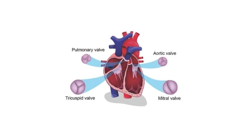 Mitral Stenosis Echo shows narrowed mitral valve area