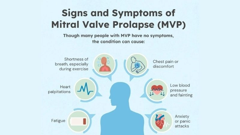 Mitral Valve Prolapse Diagnosis confirmed with echocardiogram