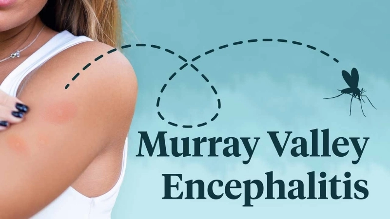 Medical care during a Murray Valley encephalitis outbreak