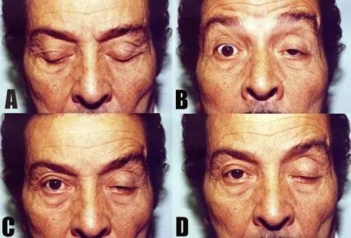 Diagram illustrating the role of the thymus gland