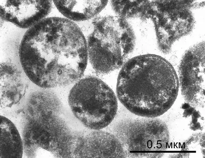 The Challenge of Antibiotic Resistance Mgen