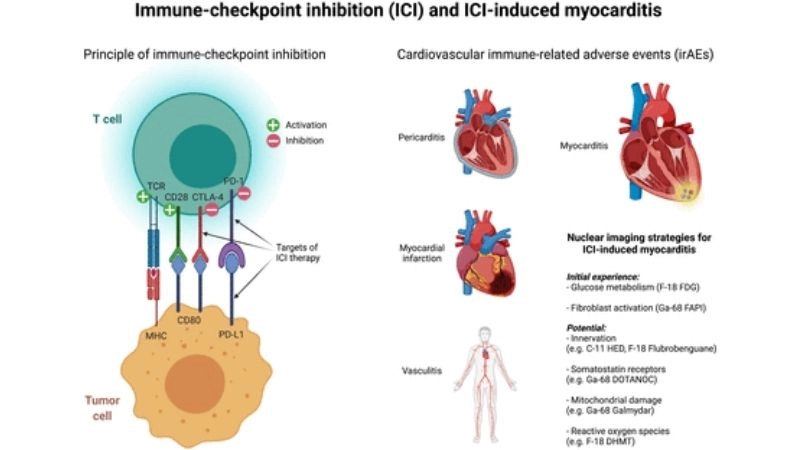 Autoimmune myocarditis immune system attack on heart tissue