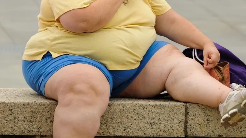 Obesity causes and contributing health factors