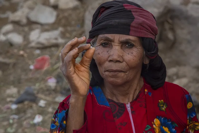 Respectful pictures of river blindness effects on vision