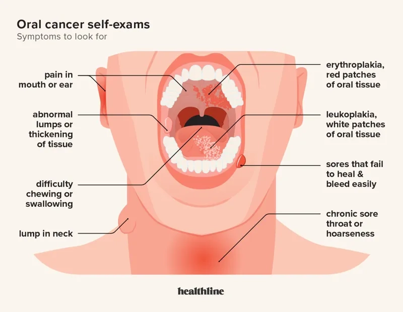 Early oral cancer symptoms awareness
