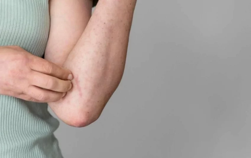 A scientist researching a potential Oropouche virus vaccine