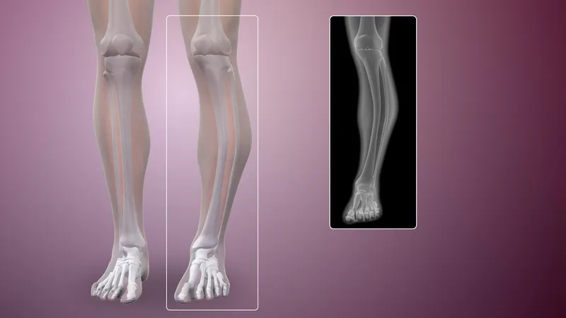 A diagram of the abnormal bone remodeling process