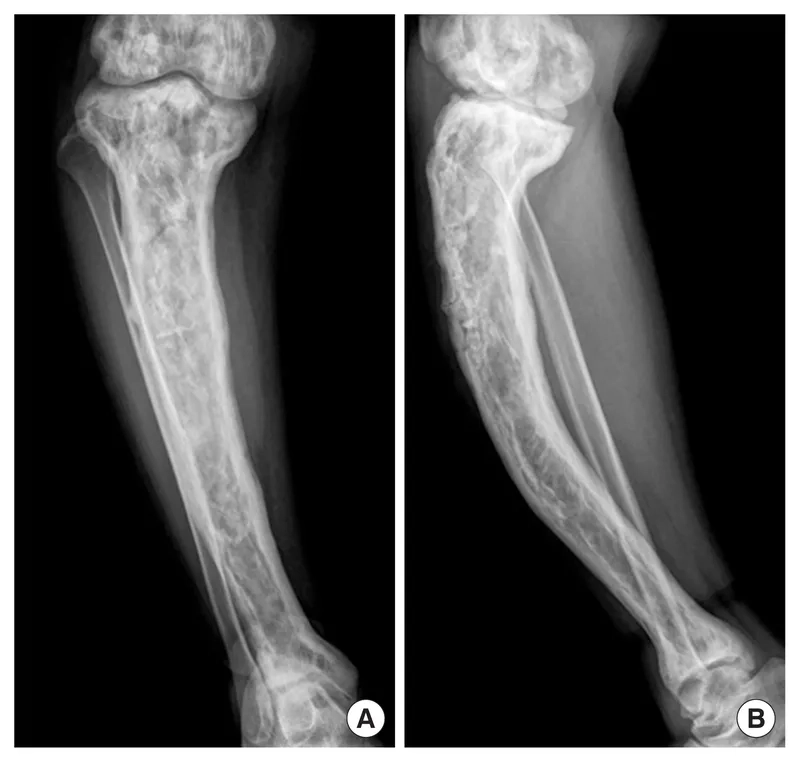 A guide to bone-healthy foods for patients