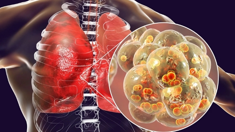 Know the spread of human parainfluenza virus clearly